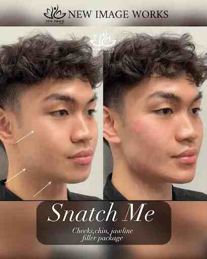 PNL, FILLER, MET, DR BAY