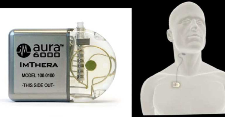 OVSOM EVA6000 migration 1TB/EVA LTU LK